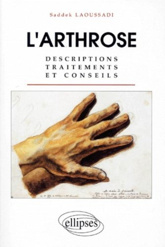 L'arthrose : descriptions, traitements et conseils