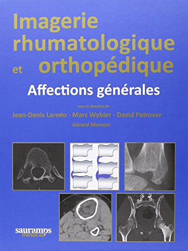 Imagerie rhumatalogique et orthopédique