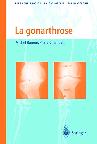 La gonarthrose