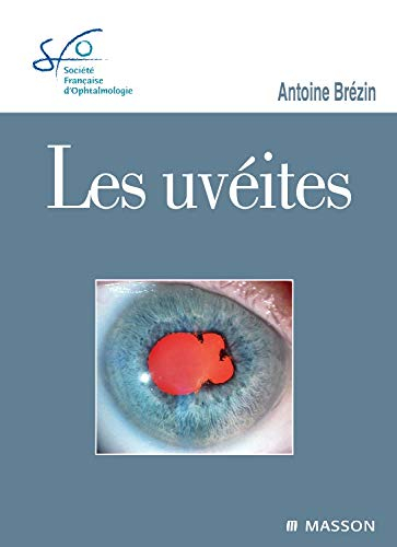 Les uvéites