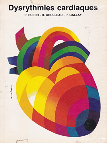 dysrythmies cardiaques