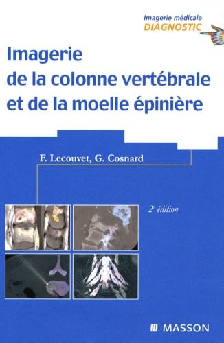 Imagerie de la colonne vertébrale et de la moelle épinière