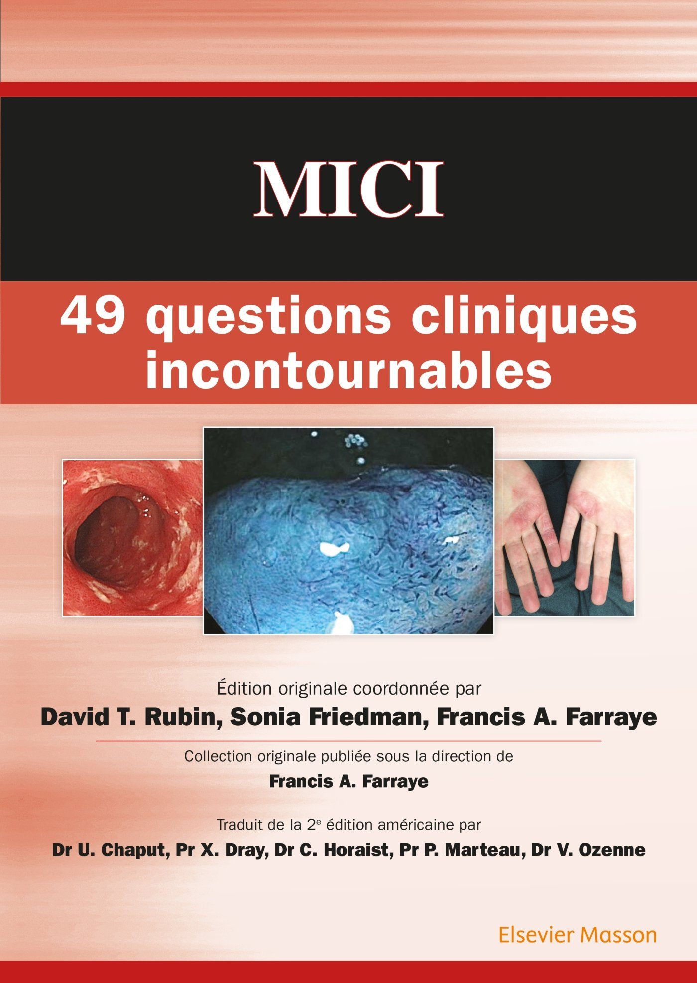 MICI : 49 questions cliniques incontournables