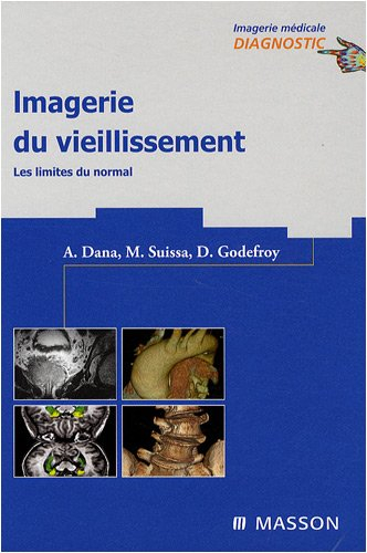 Imagerie du vieillissement : les limites du normal