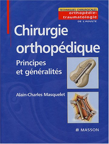 Chirurgie orthopédique : principe et généralités
