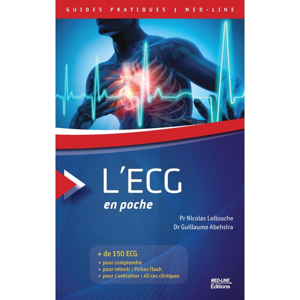 L'ECG en poche