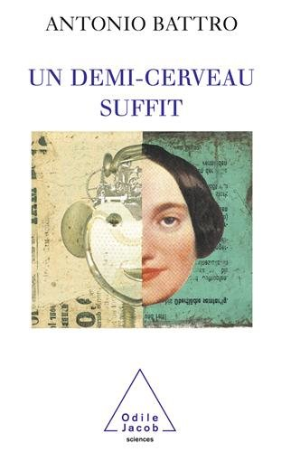 Un demi-cerveau suffit : l'histoire de Nico