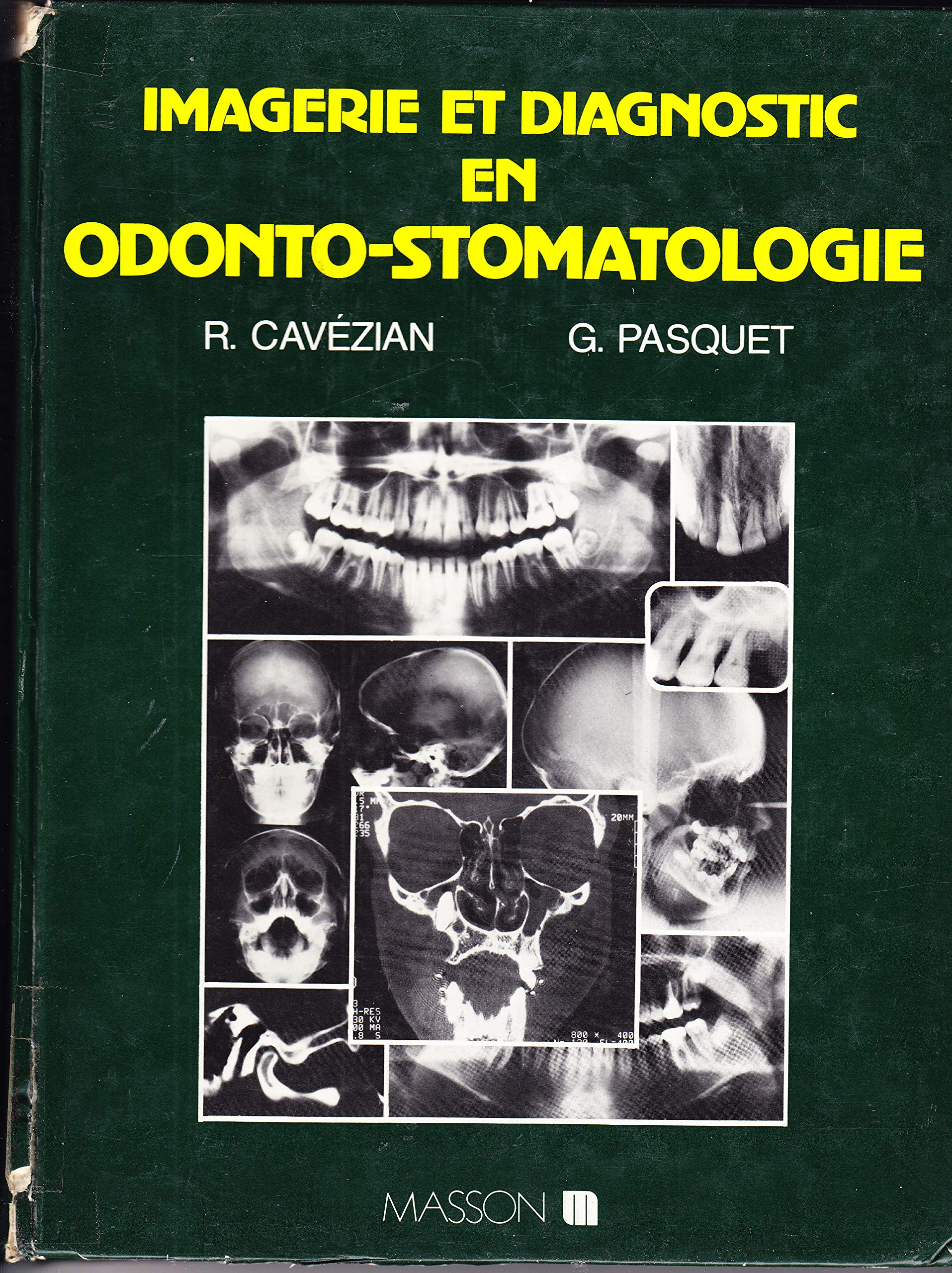 Imagerie et diagnostic en odontostomatologie : moyens techniques, anatomie normale, résultats pathol