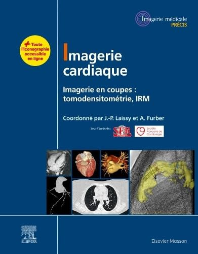 Imagerie cardiaque : imagerie en coupes : tomodensitométrie, IRM