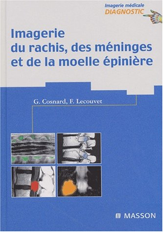 Imagerie du rachis, des méninges et de la moelle épinière