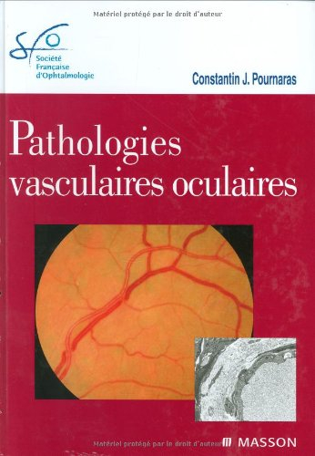 Pathologies vasculaires oculaires : rapport SFO 2008