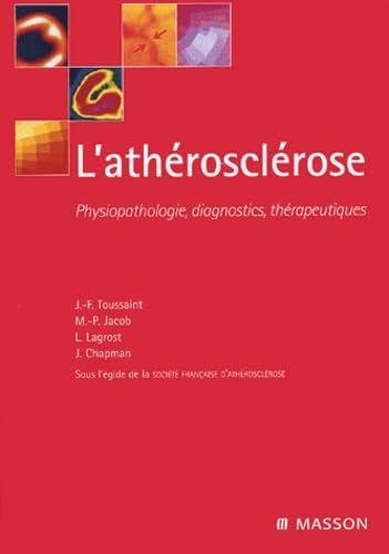 L'athérosclérose : physiopathologie, diagnostics et thérapeutiques
