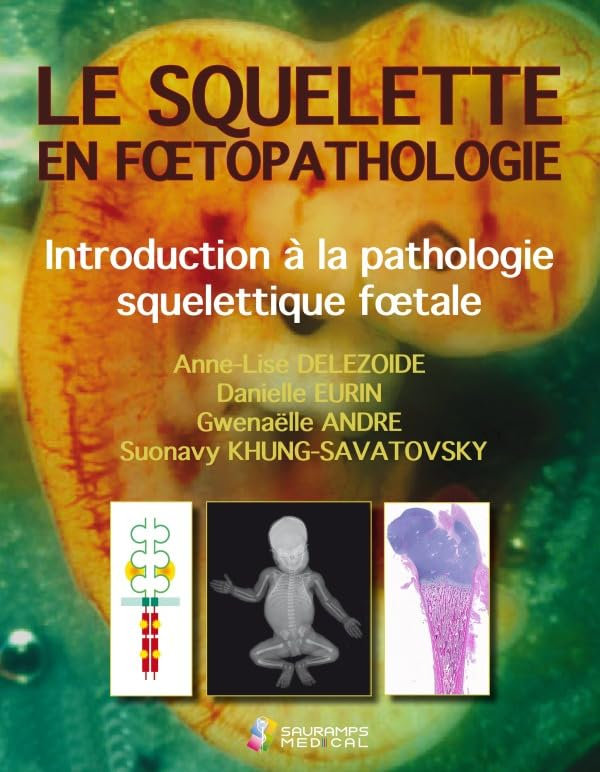 Le squelette en foetopathologie : l'os normal : développement, imagerie, structure