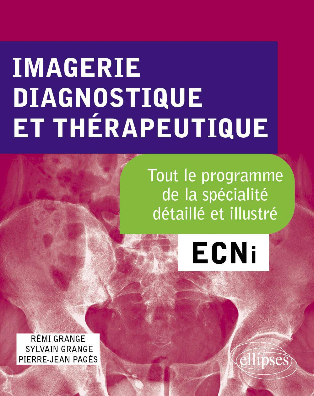 Imagerie diagnostique et thérapeutique : tout le programme de la spécialité détaillé et illustré : E