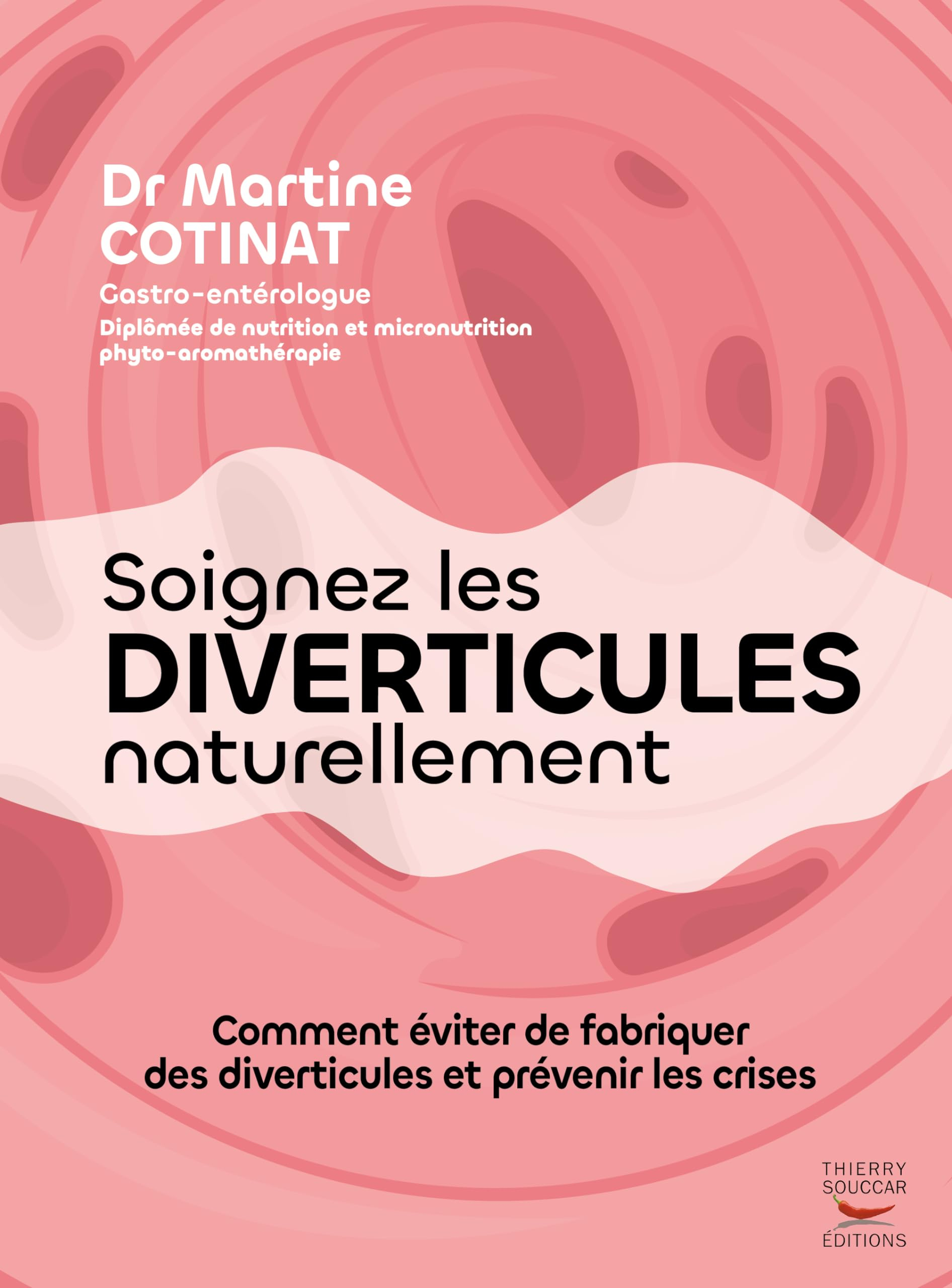 Soigner les diverticules naturellement : comment éviter de fabriquer des diverticules et prévenir le