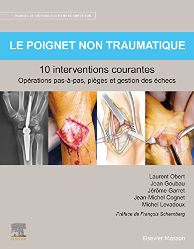 Manuel de chirurgie du membre supérieur. Le poignet non traumatique : 10 interventions courantes : o