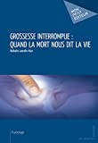 Grossesse interrompue : quand la mort nous dit la vie