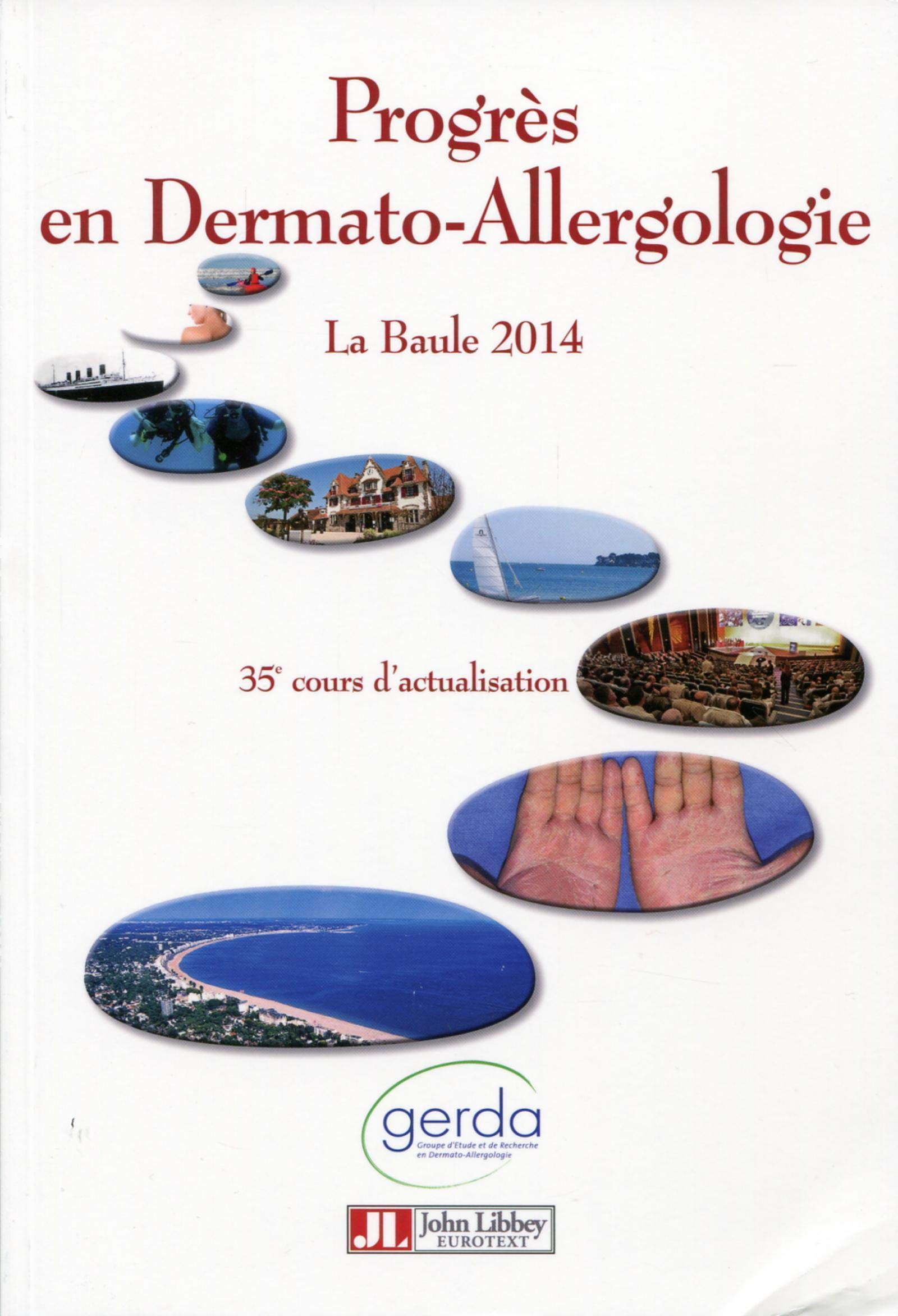 Progrès en dermato-allergologie : La Baule 2014
