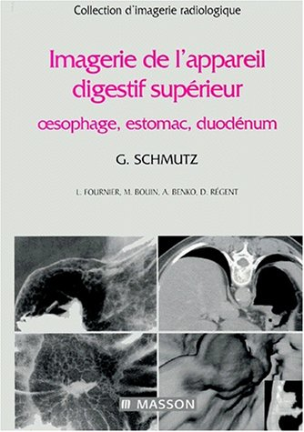 Imagerie de l'appareil digestif supérieur : oesophage, estomac, duodénum