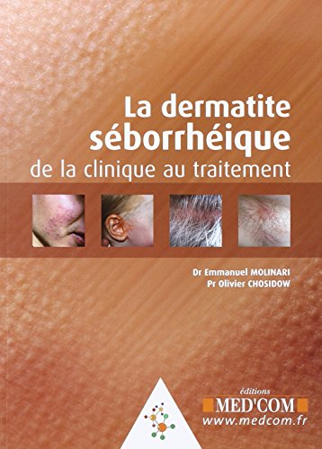 La dermatite séborrhéique : de la clinique au traitement