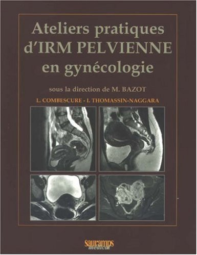 Ateliers pratiques d'IRM pelvienne en gynécologie