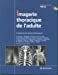 Imagerie thoracique de l'adulte