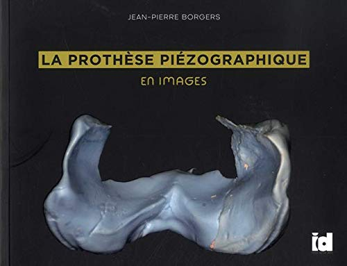 La prothèse piézographique en images
