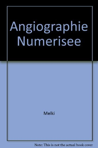 Angiographie numérisée : techniques, indications