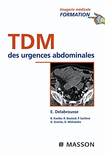 TDM des urgences abdominales
