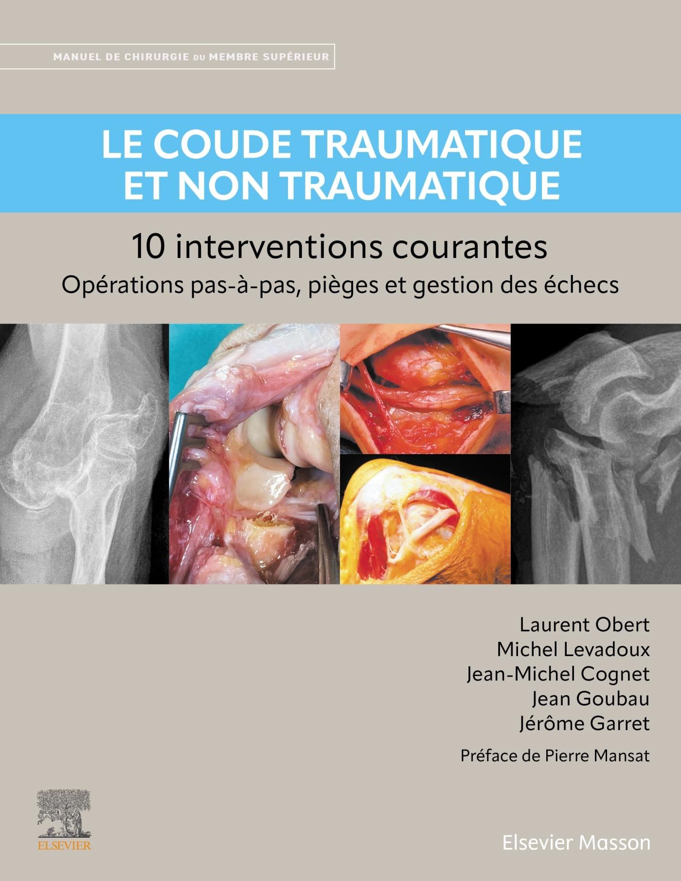Manuel de chirurgie du membre supérieur. Le coude traumatique et non traumatique : 10 interventions 