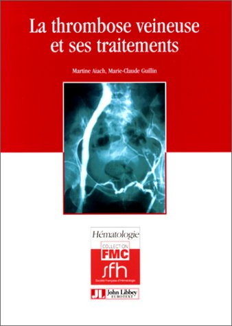 La thrombose veineuse et ses traitements