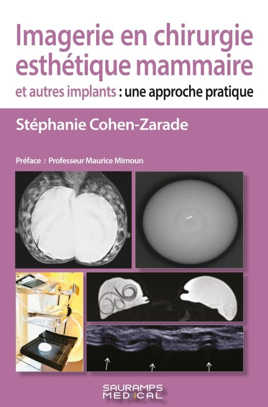 Imagerie en chirurgie esthétique mammaire et autres implants : une approche pratique