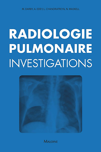 Radiologie pulmonaire : investigations